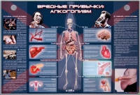 Электрифицированный стенд "Вредные привычки: алкоголизм" - «globural.ru» - Калуга