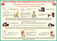 Таблица Порядок действий при опасном кровотечении 1000*1400 винил - «globural.ru» - Калуга